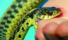 Liên tiếp trẻ bị rắn độc cắn nguy kịch, bác sĩ khuyến cáo cách xử trí và cấp cứu kịp thời