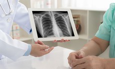 Nhập viện do tự ý điều trị viêm phổi, bác sĩ cảnh báo thói quen nhiều người thường mắc