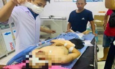 Nam sinh gần đứt lìa bàn tay sau tiếng nổ lớn