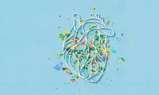 Phát hiện hạt vi nhựa trong mô tim người, tiềm ẩn nguy cơ gì đối với sức khỏe tim mạch?