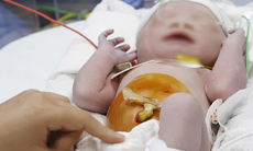 Khoảng 10.000 trẻ được sinh ra mắc tim bẩm sinh, làm sao để ngăn ngừa?