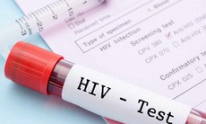 Chia sẻ kinh nghiệm triển khai xét nghiệm nhiễm mới HIV