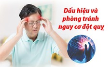 4 dấu hiệu cảnh giác và 4 bước phòng ngừa nguy cơ đột quỵ