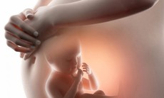 Mẹ bầu nên biết 6 yếu tố gây dị tật bẩm sinh và cách hạn chế nguy cơ