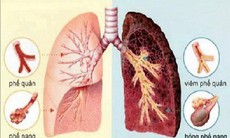 Dưỡng sinh và dùng thuốc nâng cao sức đề kháng, phòng bệnh trong mùa thu