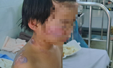 4 trẻ trong vụ cháy khi bố mẹ vắng nhà ở Tây Ninh hiện ra sao?