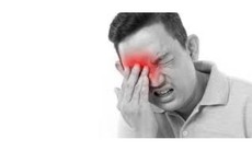 Viêm xoang tái phát mùa mưa bão – Chuyên gia cảnh báo nguyên nhân