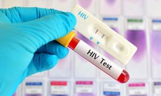 Tăng cường hoạt động tư vấn xét nghiệm HIV tại cộng đồng