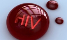 Nguy cơ nhiễm HIV ở người mắc các bệnh lây qua đường dục