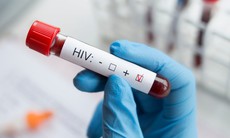 3 lợi ích từ việc xét nghiệm HIV sớm