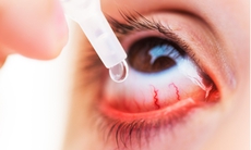 Đau mắt đỏ đang gia tăng, Bộ Y tế yêu cầu xử lý nghiêm việc lợi dụng dịch bệnh để tăng giá thuốc