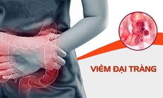 Khám phá bí mật về giải pháp hỗ trợ cho người viêm đại tràng