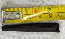 Hi hữu: Bị đũa gỗ dài gần 6cm đâm sâu vào hốc mắt