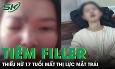 Tiêm filler tại spa, thiếu nữ 17 tuổi mất thị lực mắt trái