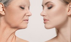 Da mặt chảy xệ khiến bạn già đi 10 tuổi, khắc phục cách nào?