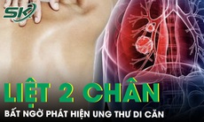 Liệt 2 chân mới bất ngờ phát hiện mắc ung thư di căn