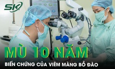 10 năm không thể nhìn thấy ánh sáng do biến chứng của viêm màng bồ đào