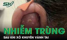 Nhiễm trùng, áp xe chảy mủ sau khi xỏ khuyên vành tai