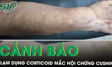 Cảnh báo hội chứng cushing do lạm dụng thuốc corticoid