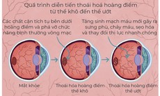 Thoái hóa hoàng điểm tuổi già - đừng bỏ quên đôi mắt mẹ cha