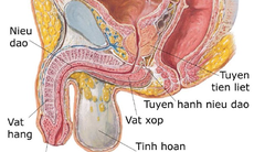 Các câu hỏi liên quan đến bệnh viêm tuyến tiền liệt