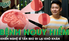 Cảnh báo căn bệnh khiến nghệ sĩ hài Tấn Beo đi lại khó khăn chỉ sau một giấc ngủ