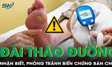 Biến chứng bàn chân tiểu đường: nhận biết để phòng ngừa!