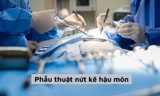 Thuốc và các phương pháp điều trị nứt kẽ hậu môn