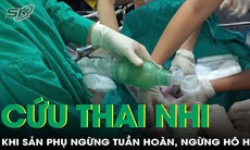 Ca mổ đặc biệt cứu thai nhi khi sản phụ ngừng tuần hoàn, ngừng hô hấp