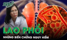 Những biến chứng nguy hiểm của bệnh lao phổi