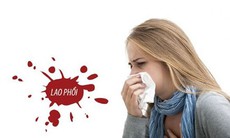 Vì sao tỉ lệ tái nhiễm lao ở người đồng nhiễm lao/HIV lại cao?