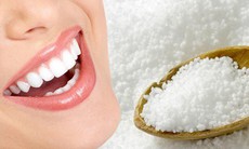 Tẩy trắng răng tại nhà cần ghi nhớ gì, bao lâu có kết quả?