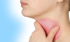 Viêm thanh quản có dẫn đến ung thư không?