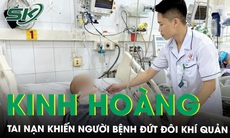 Đứt đôi khí quản, vỡ hàm mặt phức tạp do tai nạn lao động