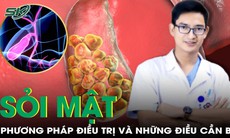 Phương pháp điều trị sỏi mật phổ biến nhất hiện nay và những điều cần biết
