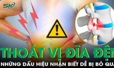 Dấu hiệu nhận biết thoát vị đĩa đệm dễ bị bỏ qua