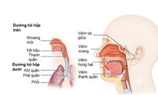 Chế độ ăn cho người bệnh viêm đường hô hấp trên