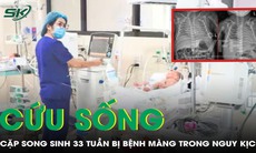 Cứu sống cặp song sinh 33 tuần bị bệnh màng trong, suy hô hấp nặng