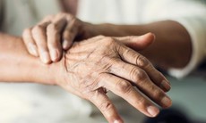 Chẩn đoán phân biệt giữa bệnh Parkinson và hội chứng Parkinson