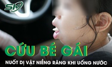 Bé gái cấp cứu do vô tình nuốt dị vật niềng răng khi uống nước