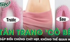 'Cô bé' bị chít hẹp, không thể quan hệ sau khi đi tân trang