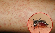 Sốt xuất huyết tăng vọt, WHO triển khai Kế hoạch toàn cầu giảm gánh nặng bệnh tật và tử vong