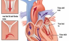 Van hai lá: Nguyên nhân, triệu chứng, phòng bệnh và cách điều trị