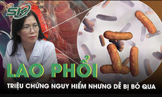 Triệu chứng lao phổi nguy hiểm nhưng dễ bị bỏ qua