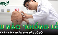 Đau đầu dữ dội bất ngờ mắc khối u não phức tạp, kích thước ‘khổng lồ’