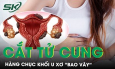 Đau đớn người phụ nữ phải cắt toàn bộ tử cung do hàng chục khối u xơ “bao vây”