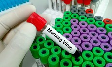 Rwanda triển khai thử nghiệm vaccine Marburg