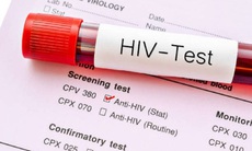 Người nhiễm HIV ở Khánh Hòa hiểu về bệnh để an tâm điều trị