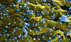 Rwanda ghi nhận thêm 7 ca nhiễm virus Marburg mới