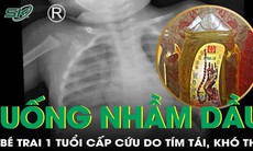 Bệnh nhi 1 tuổi tím tái khó thở sau khi uống nhầm dầu hương liệu